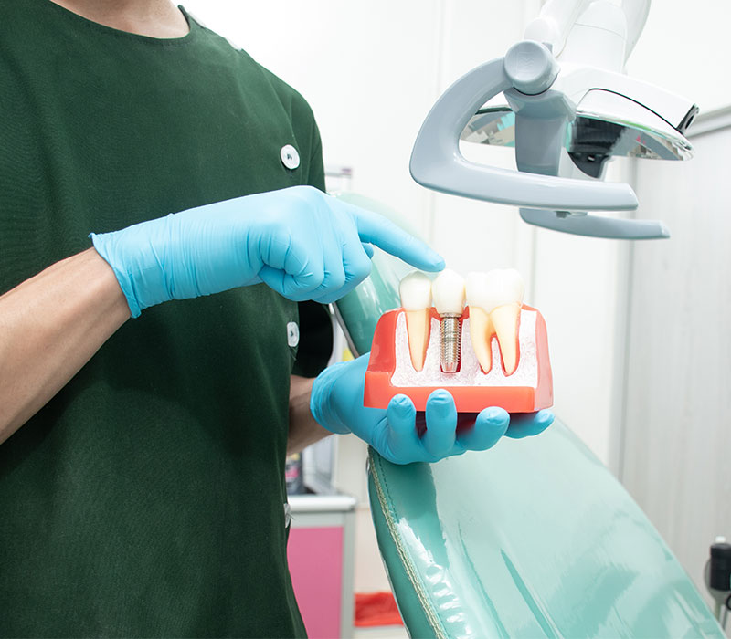 Dottore che indica un impianto dentale su protesi