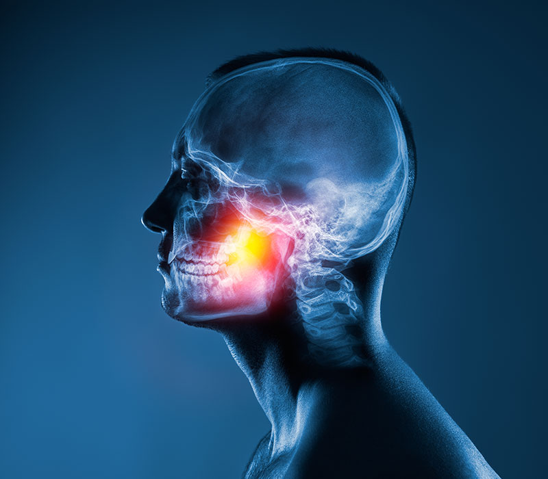 Ortodonzia fissa e mobile Dolore muscoli mandibolari