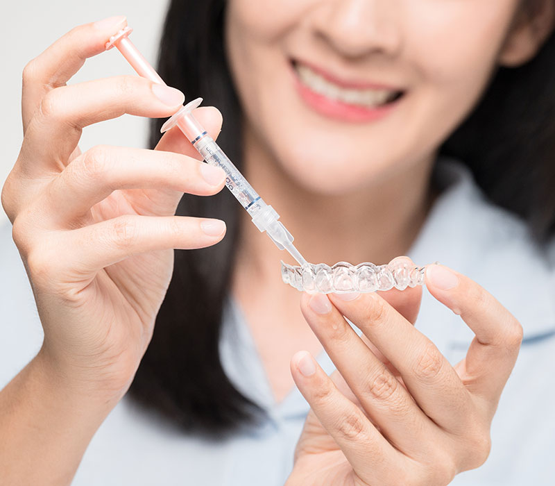 Sbiancamento dentale Sbiancamento dentale con gel